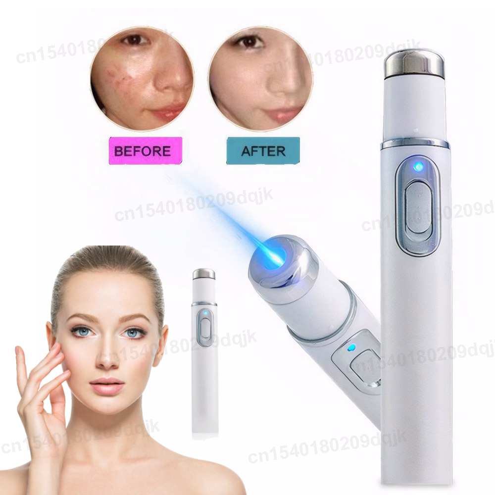Acne Light Therapy Pen - Blaulicht-Therapie, Akne-Stift, beheiztes Augenmassagegerät, Augenschönheitsgerät für