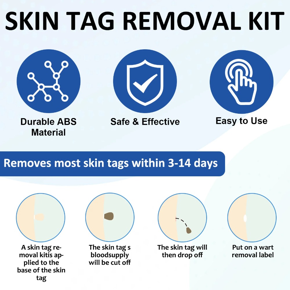 2-IN-1 Auto Haut Tag Removal T – Acne Light Therapy Pen Bewertung und Preis